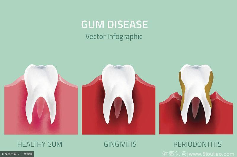 意媒:国米想要用马里奥换小德‘足球赌注软件APP’(图3) 十大足球赌注软件排行榜