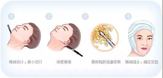 十大足球赌注软件|绿城中国:拟分拆绿城管理于港交所上市发行(图2) 十大足球赌注软件